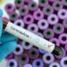 Africa records nearly 1, 000 deaths, over 17, 000 infections